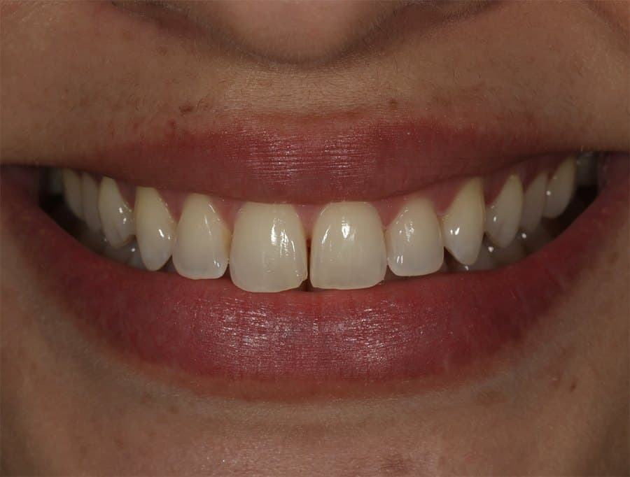 Fotografia do sorriso no acompanhamento de maio